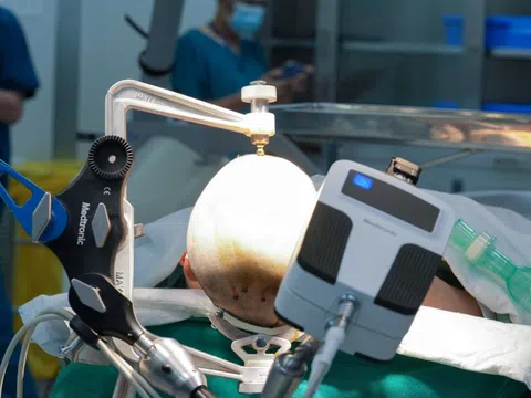 Vinmec Central Park mở lối đi mới trong điều trị động kinh bằng công nghệ Robot đỉnh cao