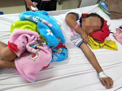 Cháu bé 7 tuổi nhập viện với 200 vết ong đốt gây bội nhiễm, tổn thương giác mạc