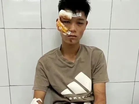 Lời khai của quái xế "thông chốt", lao xe vào cảnh sát cơ động