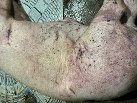 Triệt phá nhóm đối tượng mua bán lợn chết do dịch bệnh làm thực phẩm