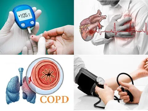 Sàng lọc sớm - Lá chắn vàng giúp giảm gánh nặng bệnh không lây nhiễm