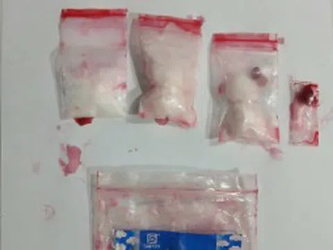 Vật thể trong bồn cầu "bóc trần" hành vi sai trái của thiếu niên 17 tuổi