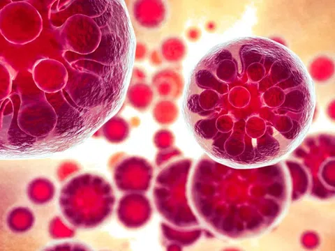 Nhiễm trùng nấm khiến 1 người nguy kịch và 18 ca mắc bệnh