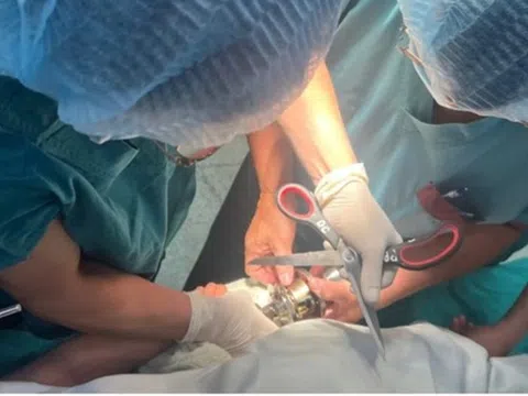 Bé trai 5 tuổi "ôm" ổ khóa nhập viện cấp cứu, bác sĩ phát cảnh báo khẩn