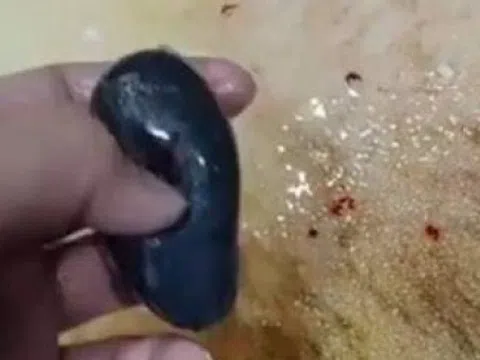 Nuốt mật cá sống để chữa đau đầu, người phụ nữ nhận kết đắng