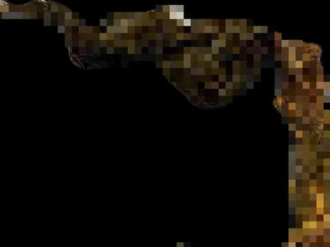 Bé gái 9 tuổi có thói quen lạ đời, bác sĩ gắp ra thứ "đáng sợ" trong bụng