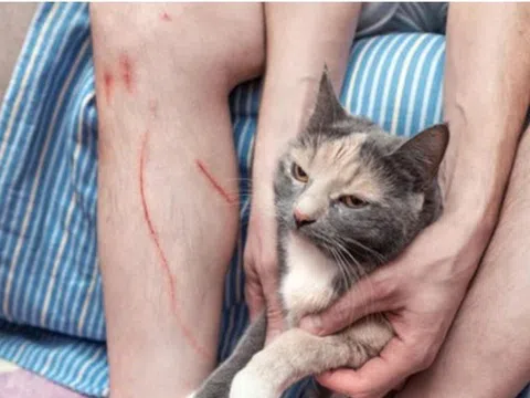 Bị mèo cào, người đàn ông 71 tuổi tử vong trong đau đớn