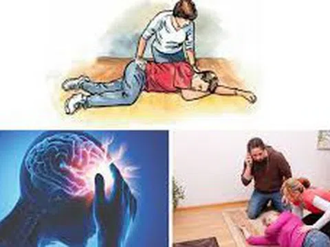 Đột quỵ não gia tăng và những dấu hiệu cảnh báo