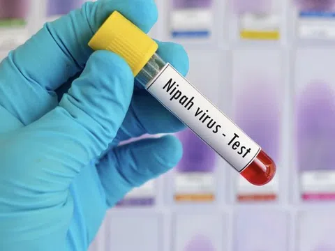 Không chủ quan với dịch bệnh do virus Nipah
