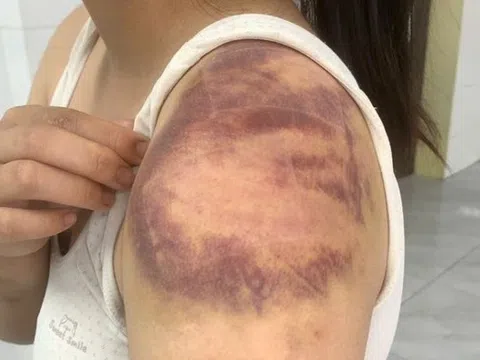 Bắt đối tượng ngược đãi, hành hạ vợ và con gái