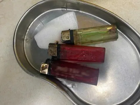 Bác sĩ sốc khi phát hiện 3 chiếc bật lửa trong bụng nam thanh niên