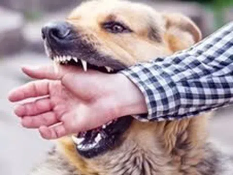 TP Hồ Chí Minh: Người đàn ông tử vong do bệnh dại sau khi bị chó cắn