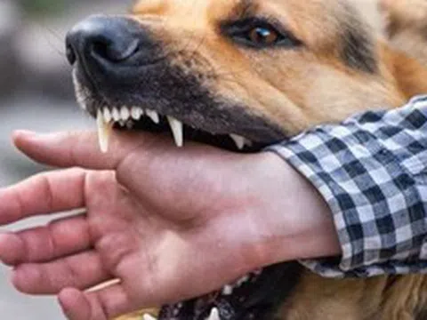 Sự cố thương tâm: Cụ ông 83 tuổi tử vong do chó nuôi trong nhà tấn công