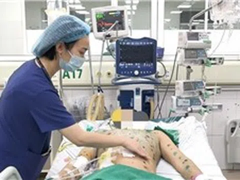 Gia tăng ca mắc thủy đậu, cảnh báo nguy cơ biến chứng nặng