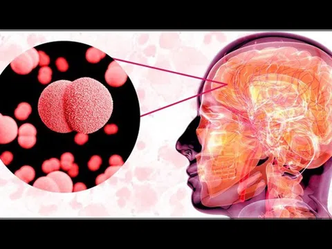 Bệnh nguy hiểm đã có 4 ca không qua khỏi, Viện Pasteur Tp.HCM cảnh báo