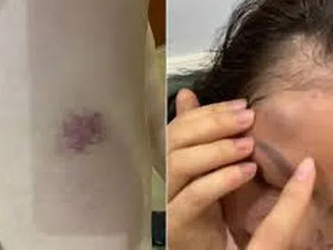 Hà Nội: Công an vào cuộc vụ một gia đình tố bị hàng xóm liên tục đe dọa, hành hung