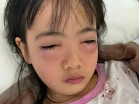 Chơi bong bóng xà phòng, bé 5 tuổi nguy kịch phải cấp cứu, sự thật khiến mẹ "sốc nặng"