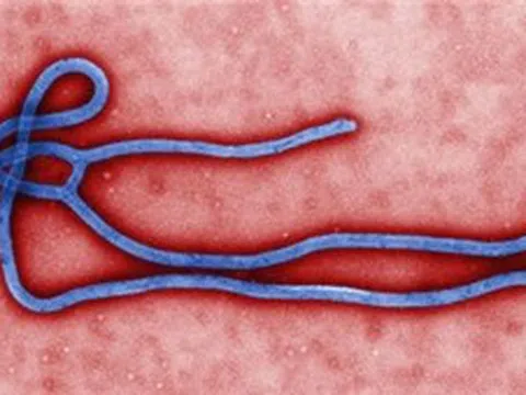 Bộ Y tế tăng cường giám sát trước nguy cơ dịch Ebola