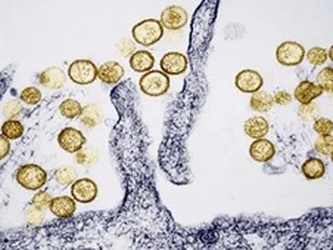 Những điều cần biết về virus Hanta