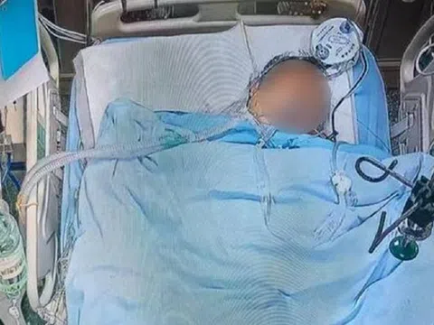 Người đàn ông 60 tuổi tử vong, bác sĩ nói ngay: Mùa hè thà ăn ít thịt cũng đừng quên 5 món "vạn người mê" này