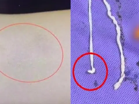 Người phụ nữ đau tay đi khám, bác sĩ kinh ngạc khi thấy thứ bên trong