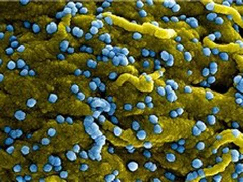 Phát hiện ca nhiễm virus Marburg tại Uganda