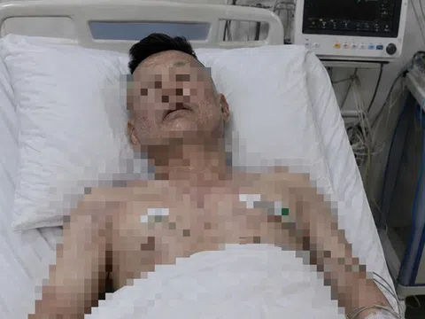 Người đàn ông 46 tuổi tử vong trên giường, bác sĩ cảnh báo loại đồ uống quen thuộc "vạn người mê"