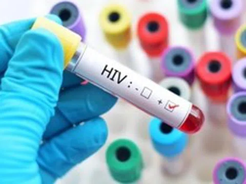 Quy định mới về cấp giấy chứng nhận bị phơi nhiễm HIV do tai nạn rủi ro nghề nghiệp